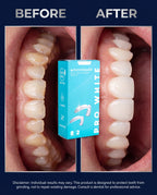 Pro White Grind Defense Night Guard — before and after results