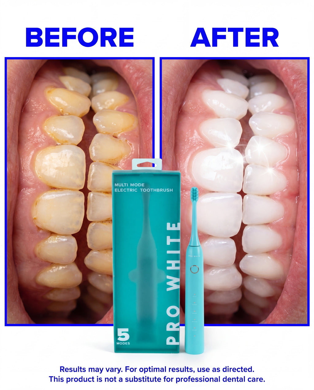 Pro White Multi-Mode Sonic Electric Toothbrush — creator hold
