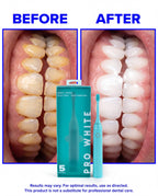 Pro White Multi-Mode Sonic Electric Toothbrush — creator hold