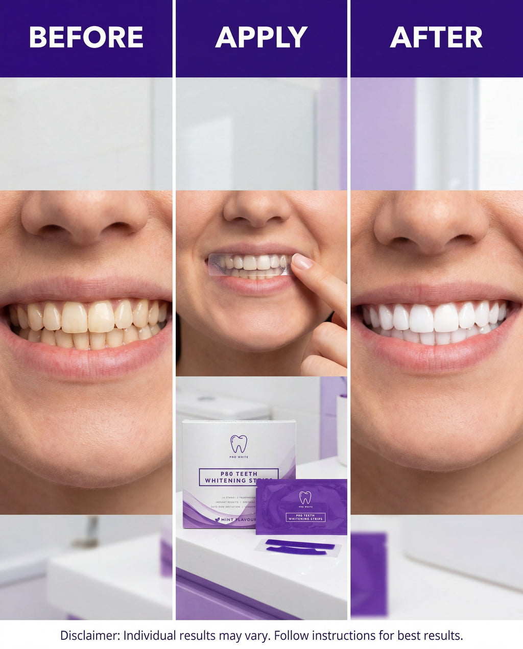 Pro White p80 Teeth Whitening Strips — Gen Z bold creative