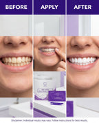 Pro White p80 Teeth Whitening Strips — Gen Z bold creative
