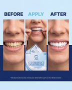 Pro White PAP-X Advanced Non-Slip Teeth Whitening Strips — hero editorial