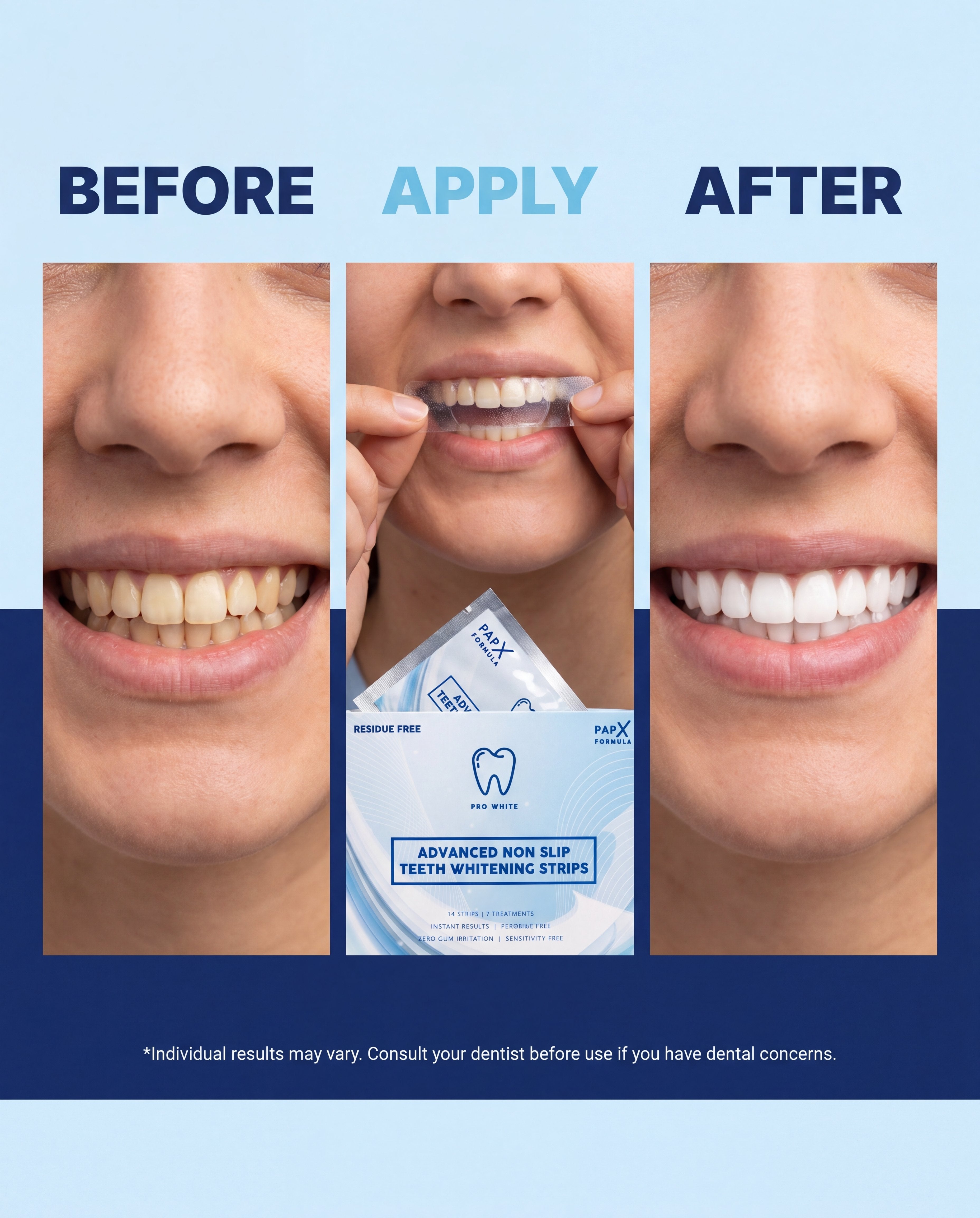 Pro White PAP-X Advanced Non-Slip Teeth Whitening Strips — hero editorial