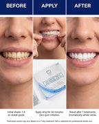 Pro White PAP-X Advanced Teeth Whitening Strips — Gen Z bold creative
