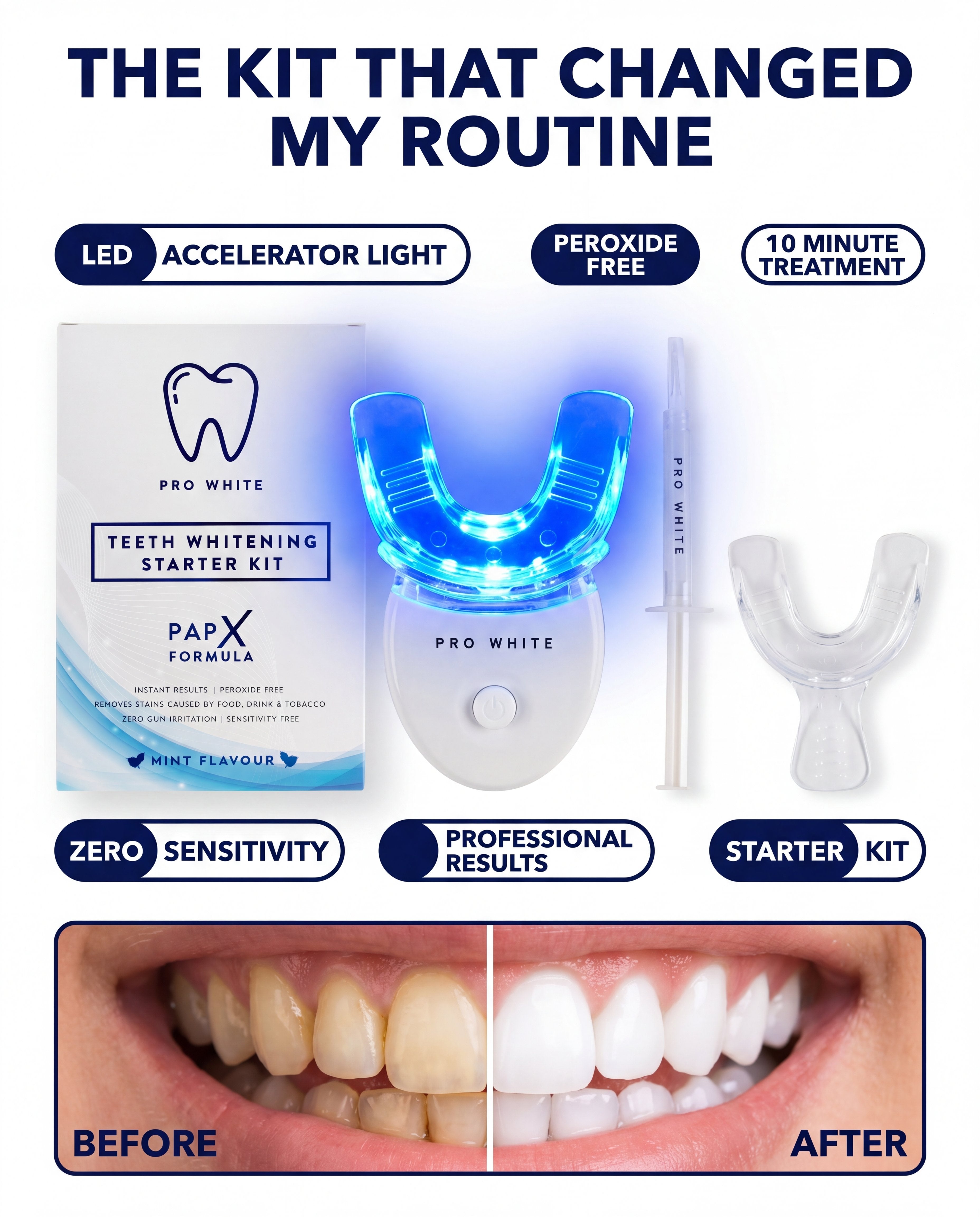 Pro White PAP-X Starter Teeth Whitening Kit — hero editorial