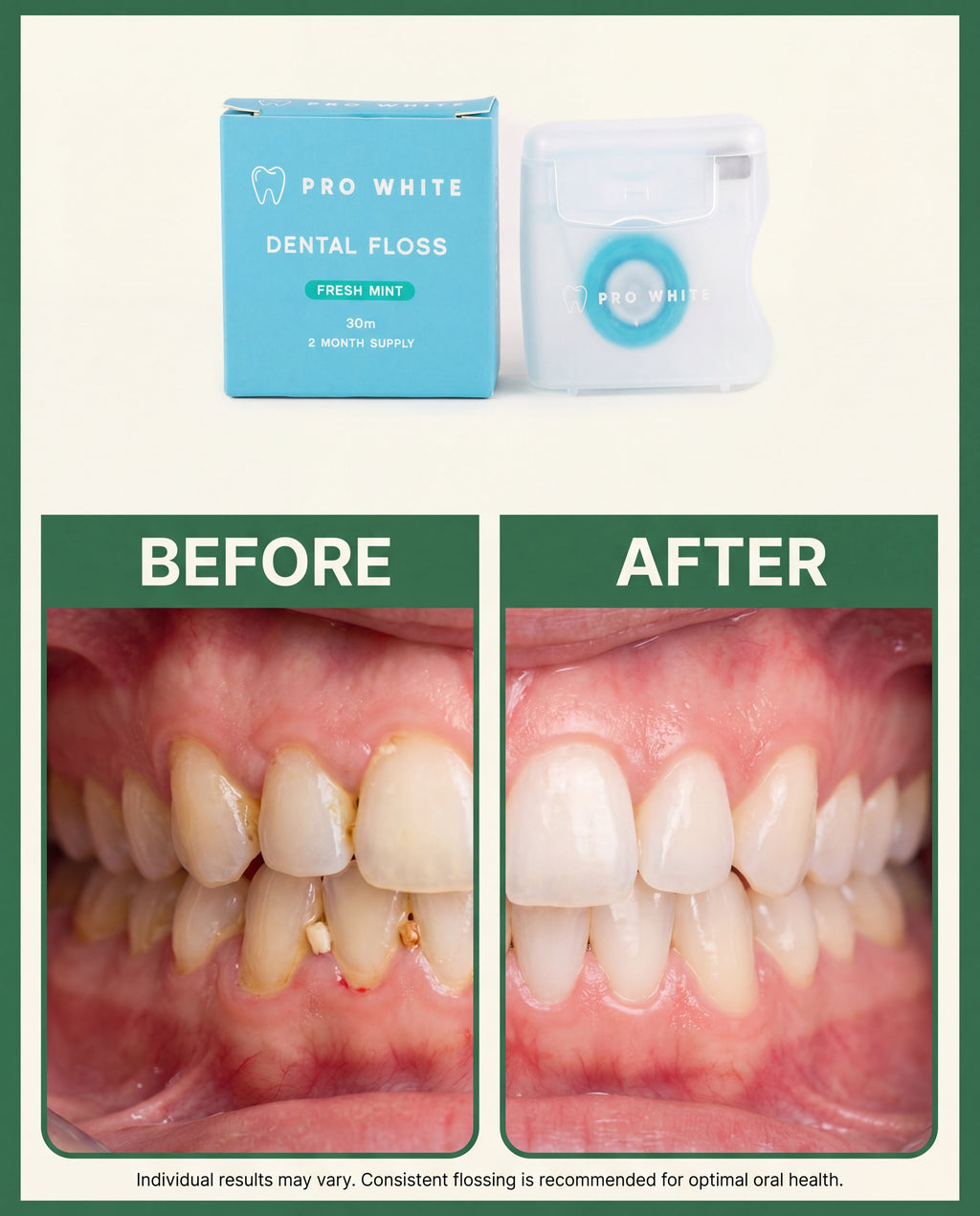 Pro White Eco Dental Floss — creator hold