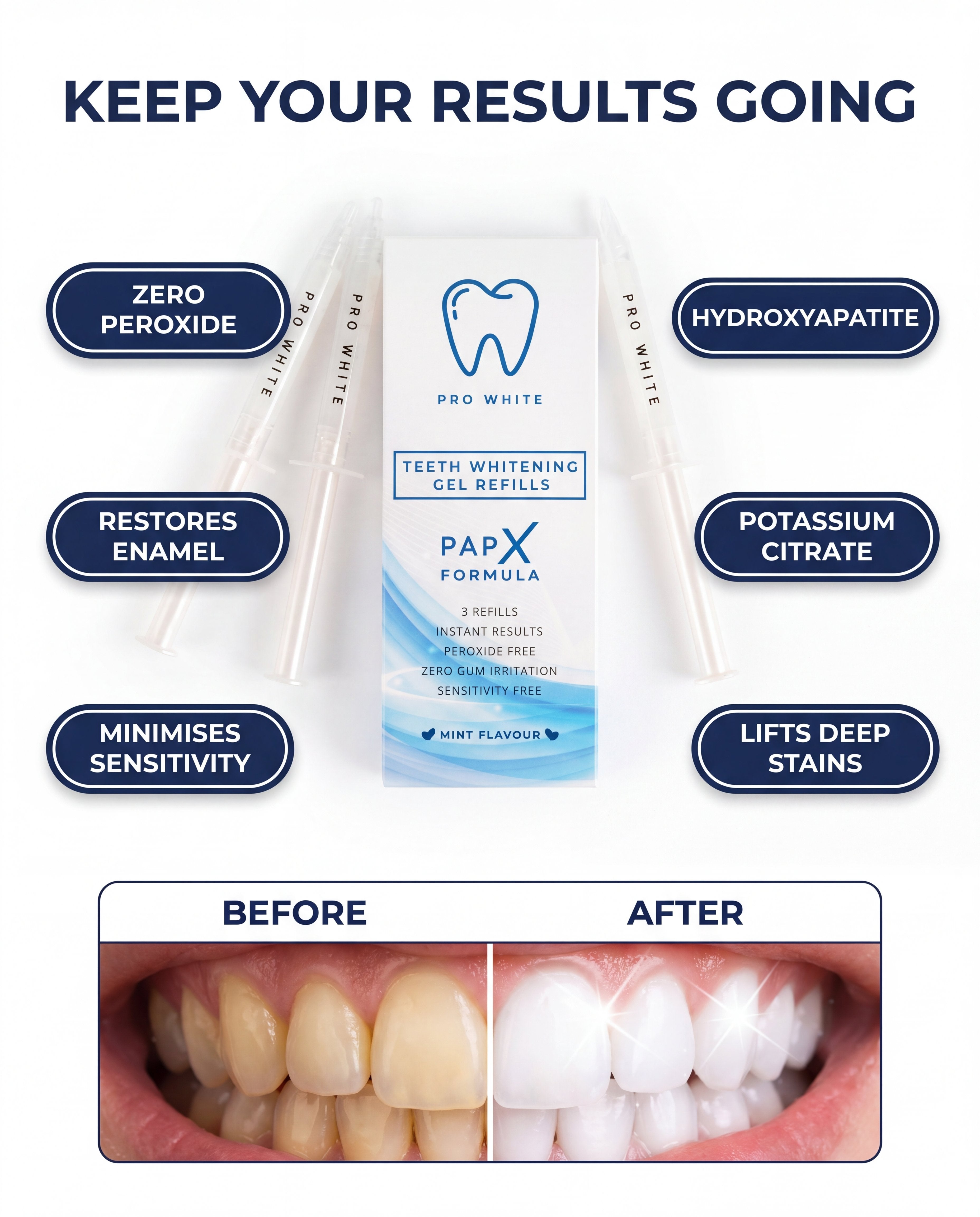 Pro White PAP-X Teeth Whitening Refills — advertorial infographic