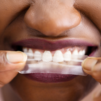 All Rounder Whitening Set - PAP-X™ Advanced Teeth Whitening Strips & Pen